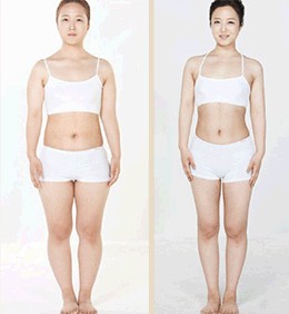 抽脂手術(shù)后的痛苦經(jīng)歷，抽脂手術(shù)后的艱辛歷程